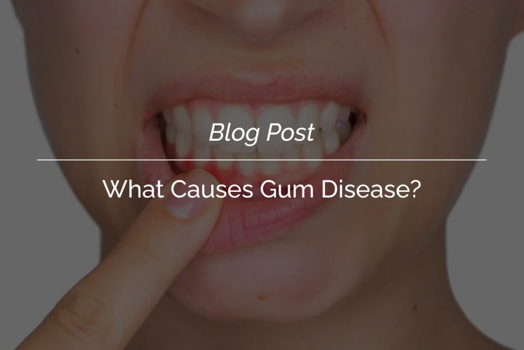 Can Tooth Decay Be Reversed_